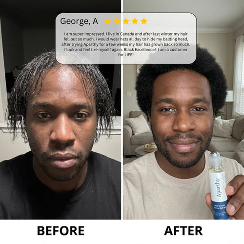 Beno Rosemary Hair Growth Roll-On