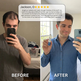 Beno Rosemary Hair Growth Roll-On