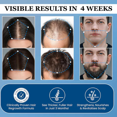 Beno Rosemary Hair Growth Roll-On